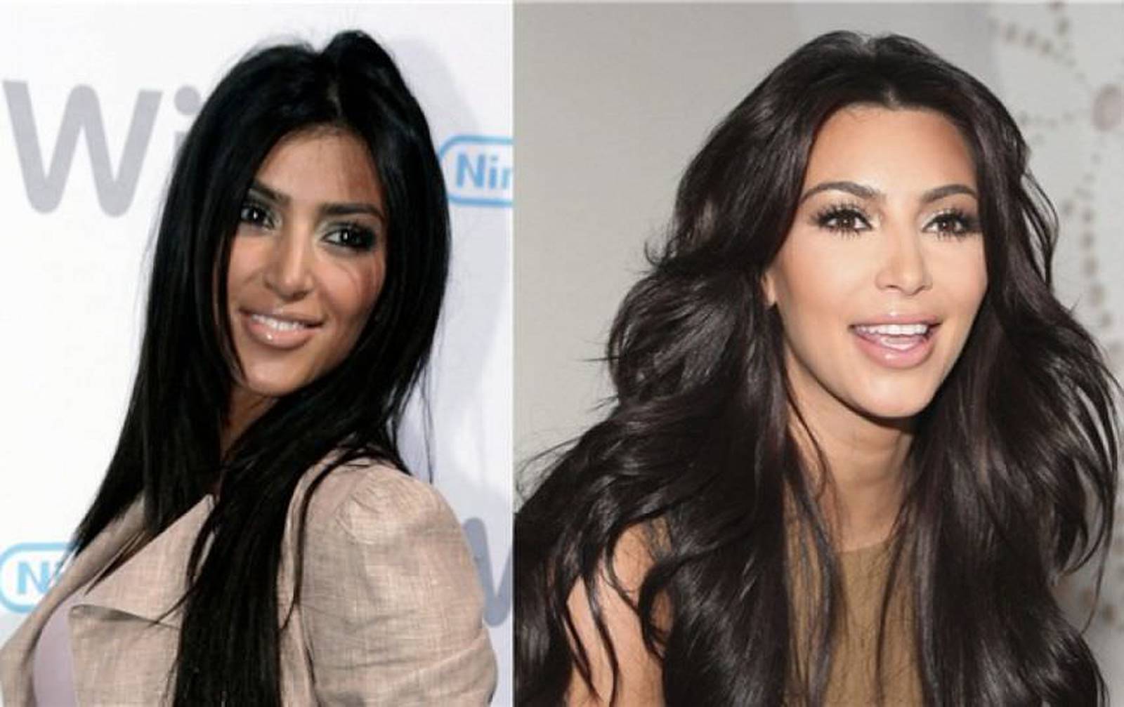 Fotos Kim Kardashian Antes Y Después De Las Cirugías Publimetro México 