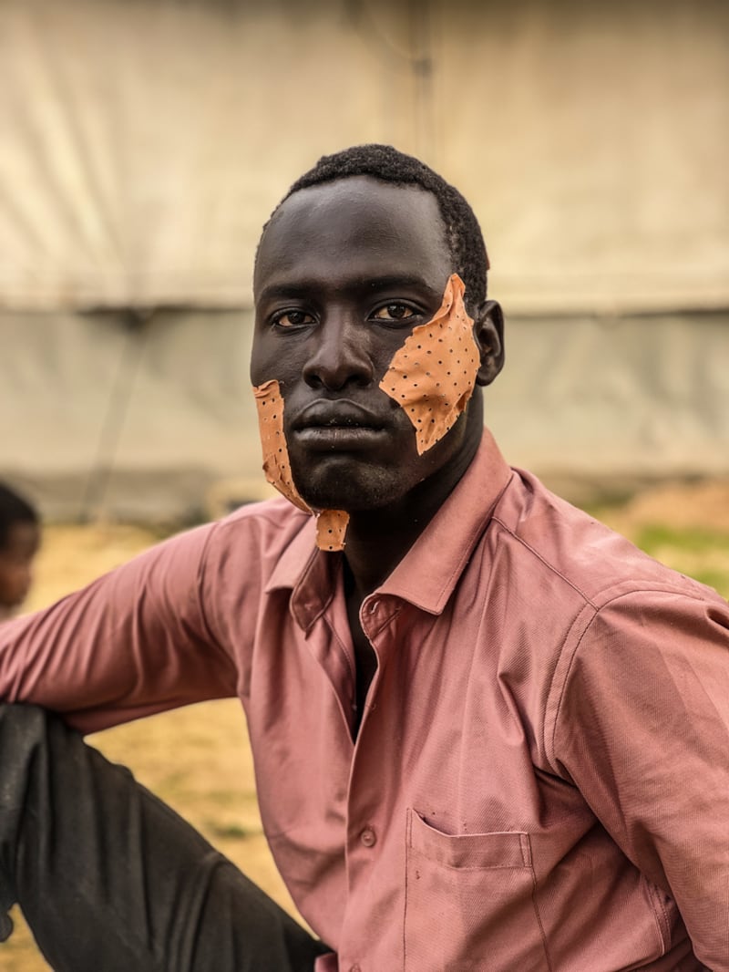 Adré, Chad, junio de 2023. Nour escapó de la guerra en El Geneina, Sudán, con heridas en el rostro. Al llegar a Adré, en Chad, cerca de la frontera con Sudán, los equipos de MSF le brindaron atención médica a él y a cientos de otros heridos de guerra.