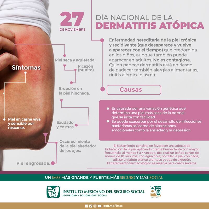 Día Nacional de la Dermatitis Atópica