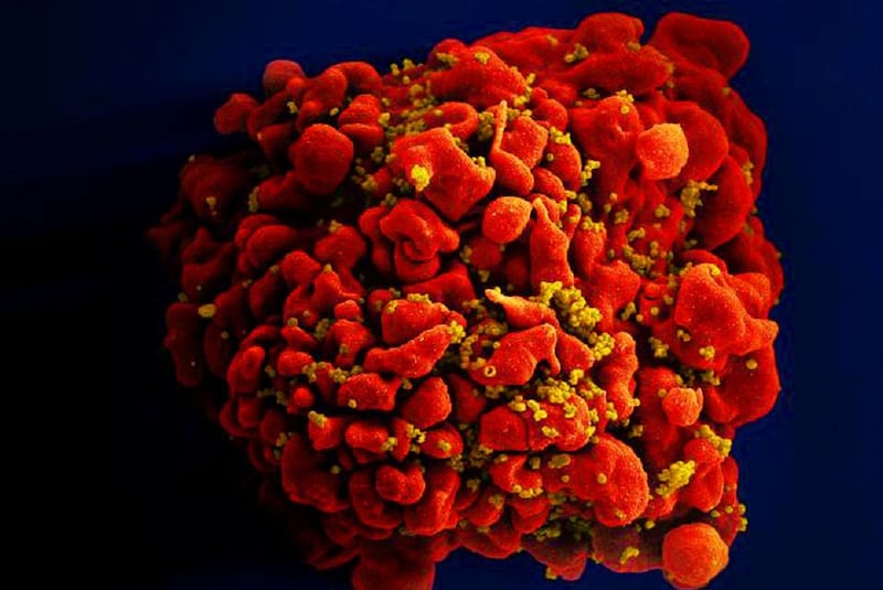Imagen al microscopio electrónico del VIH infectando una célula humana.