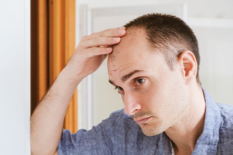 Hombre calvo/con alopecia/calvicie