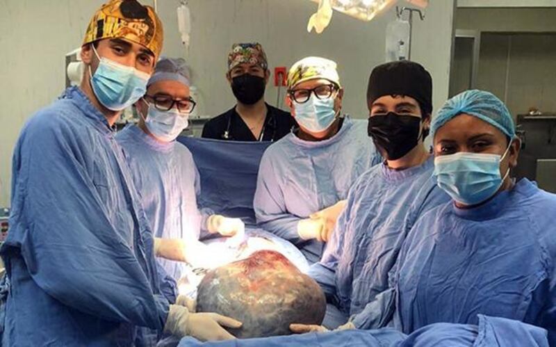 Médicos del IMSS retiran tumor de 21 kilogramos a mujer en Guanajuato