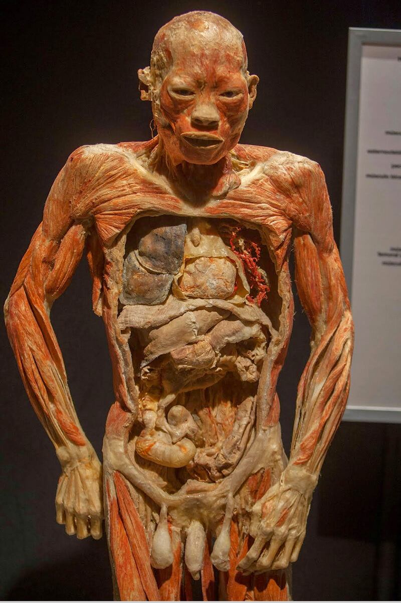 Cuerpos de plastinación