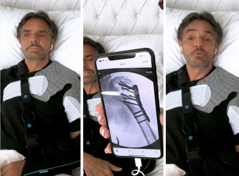 Eugenio Derbez  habla de su estado de salud