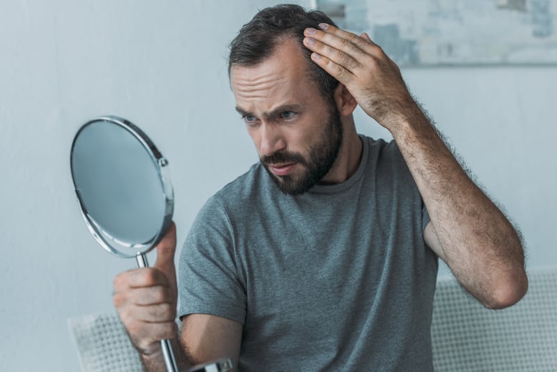 Hombre calvo/con alopecia/calvicie