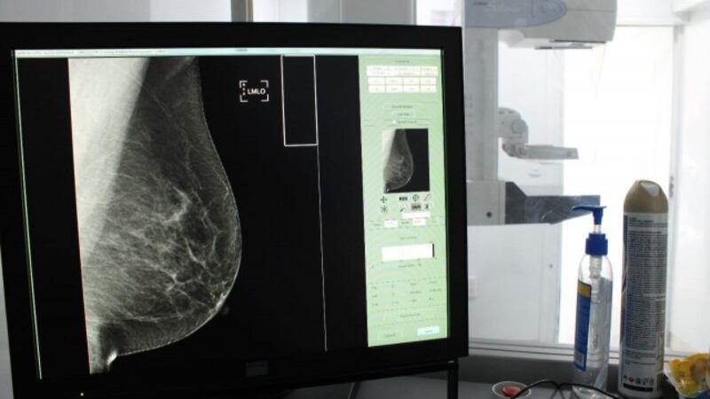 mastografía cáncer de mama