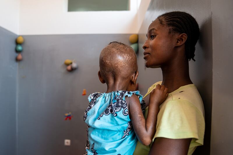 Cuvango, provincia de Huila, Angola, mayo de 2023. Paulina Cassombu carga a su hija Rosa, que tres semanas antes fue ingresada en el hospital municipal de Cuvango con desnutrición grave y pérdida de movilidad.